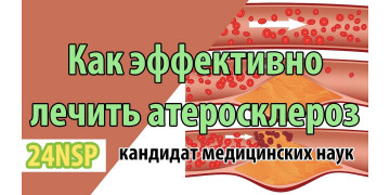 Как эффективно лечить атеросклероз сосудов? Атеросклероз - симптомы и причины! ✓Лекция от к.м.н.